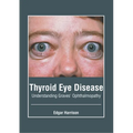 Thyroid Eye Disease: Understanding Graves' Ophthalmopathy - Hardcover