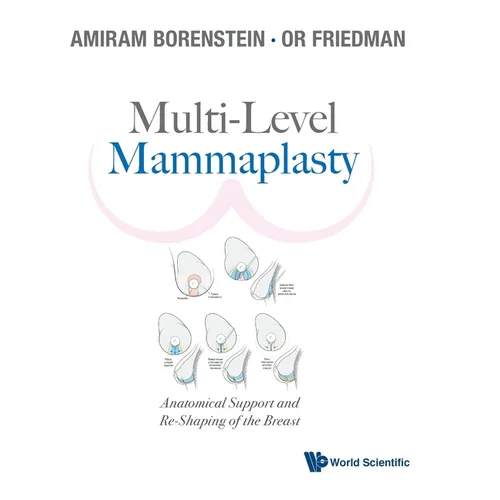 Multi-Level Mammaplasty - Hardcover
