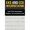 EKG and ECG Interpretation: Learn EKG Interpretation, Rhythms, and Arrhythmia Fast! - Paperback