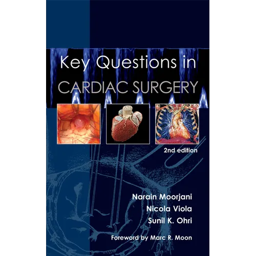 Key Questions in Cardiac Surgery - Paperback