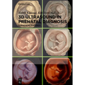 3D Ultrasound in Prenatal Diagnosis: A Practical Approach - Hardcover