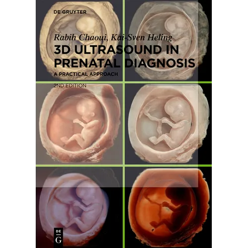 3D Ultrasound in Prenatal Diagnosis: A Practical Approach - Hardcover