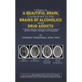 I Have a Beautiful Brain, Compared to the Brains of Alcoholics and Drug Addicts - Paperback