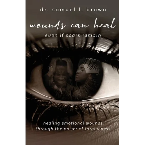 Wounds Can Heal, Even If Scars Remain - Paperback