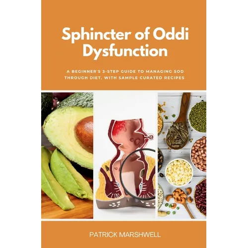 Sphincter of Oddi Dysfunction: A Beginner's 3-Step Guide to Managing SOD Through Diet, With Sample Curated Recipes - Paperback