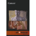 Cancer - Paperback