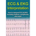 ECG & EKG Interpretation: How to interpret ECG & EKG, including rhythms, arrhythmias, and more! - Paperback