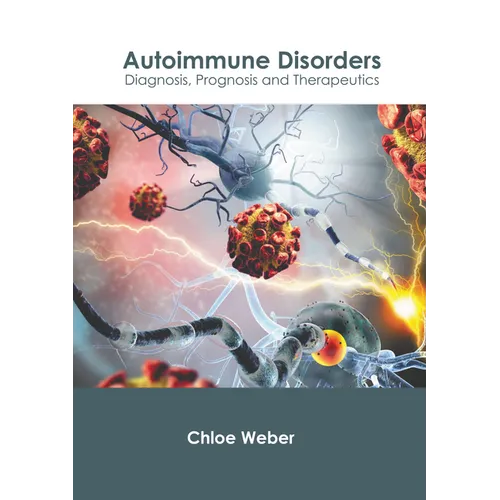 Autoimmune Disorders: Diagnosis, Prognosis and Therapeutics - Hardcover
