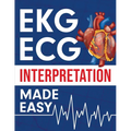 EKG ECG Interpretation Made Easy - Paperback