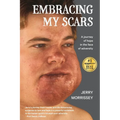 Embracing My Scars: A journey of hope in the face of adversity - Paperback