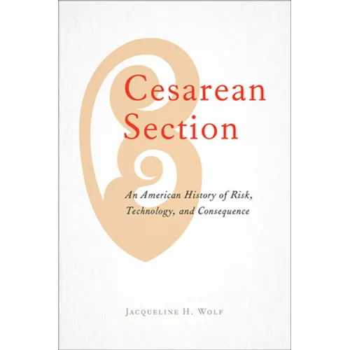 Cesarean Section: An American History of Risk, Technology, and Consequence - Paperback