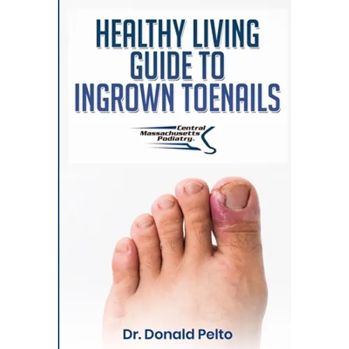 The Healthy Living Guide to Ingrown Toenails - Paperback
