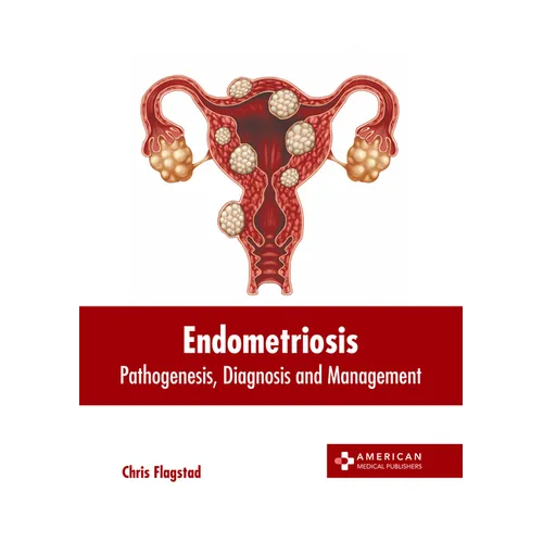 Endometriosis: Pathogenesis, Diagnosis and Management - Hardcover