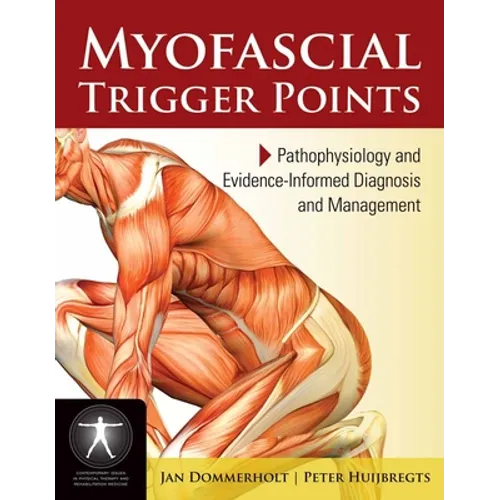 Myofascial Trigger Points: Pathophysiology and Evidence-Informed Diagnosis and Management: Pathophysiology and Evidence-Informed Diagnosis and Managem - Paperback