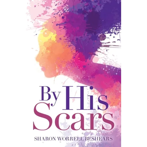 By His Scars - Paperback