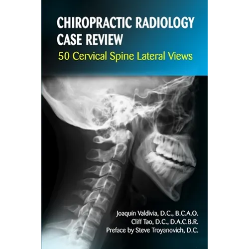 Chiropractic Radiology Case Review: 50 Cervical Spine Lateral Views - Paperback