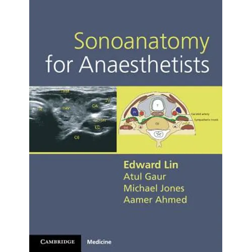 Sonoanatomy for Anaesthetists - Spiral