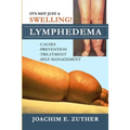 It's Not Just a Swelling! Lymphedema: Causes, Prevention, Treatment, Self-Management - Paperback