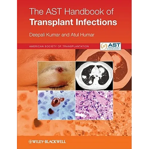The Ast Handbook of Transplant Infections - Paperback