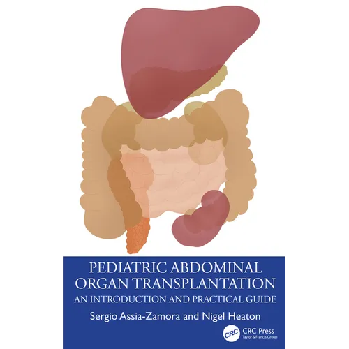 Pediatric Abdominal Organ Transplantation: An Introduction and Practical guide - Paperback