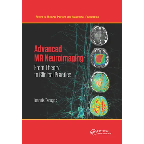 Advanced MR Neuroimaging: From Theory to Clinical Practice - Paperback