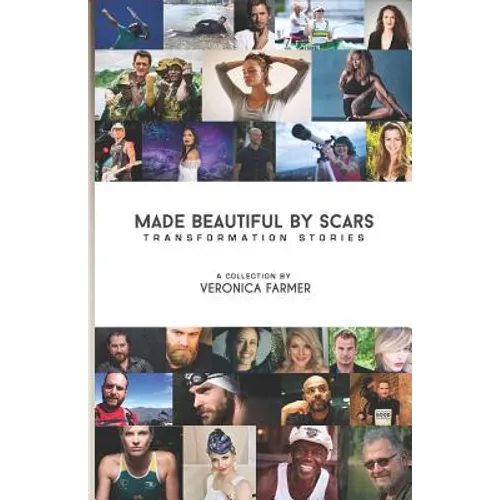 Made Beautiful by Scars: Transformation Stories - Paperback