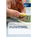 Soft Tissue Management in Fixed Partial Dentures - Paperback