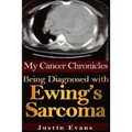 My Cancer Chronicles: Being Diagnosed with Ewing's Sarcoma - Paperback